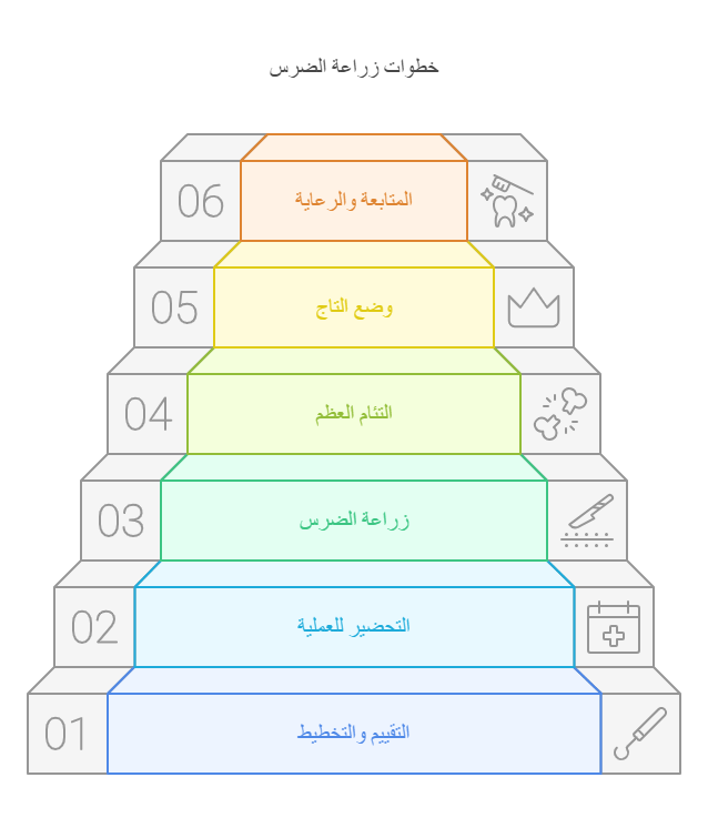 صورة توضح ال6 خطوات الأساسية لزراعة الضرس