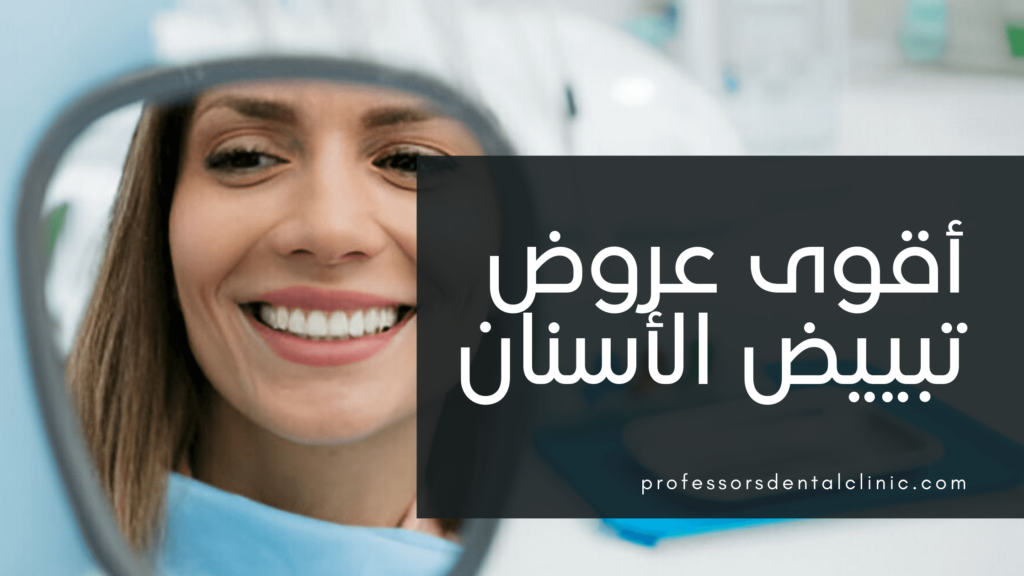 أقوى عروض تبييض الأسنان – 20% خصم لفترة محدودة