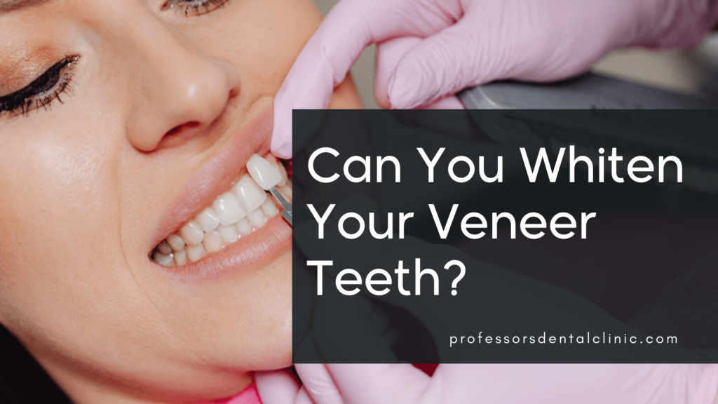 Is it Possible to Whiten Veneer Teeth?