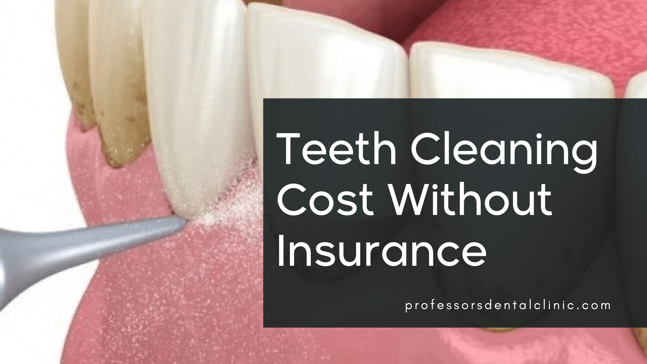 Cost of Teeth Cleaning Without Insurance in Egypt