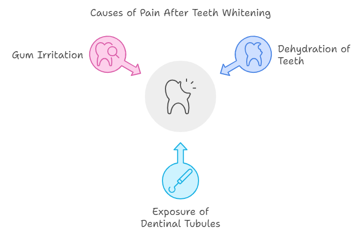 Causes of Pain After Teeth Whitening