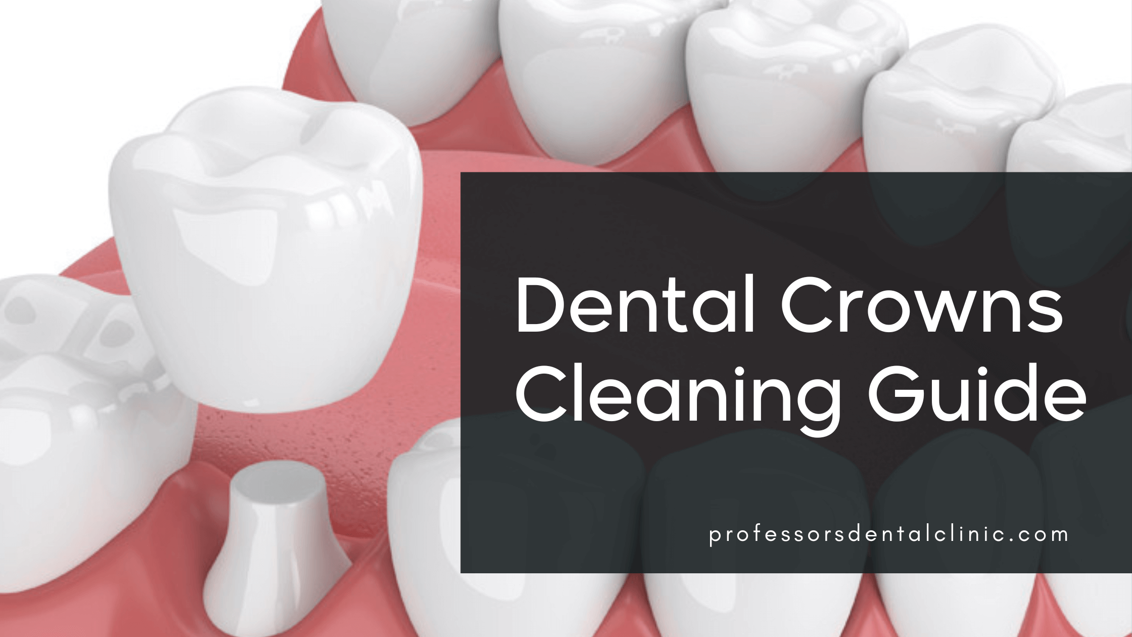 How to Clean Crown Teeth