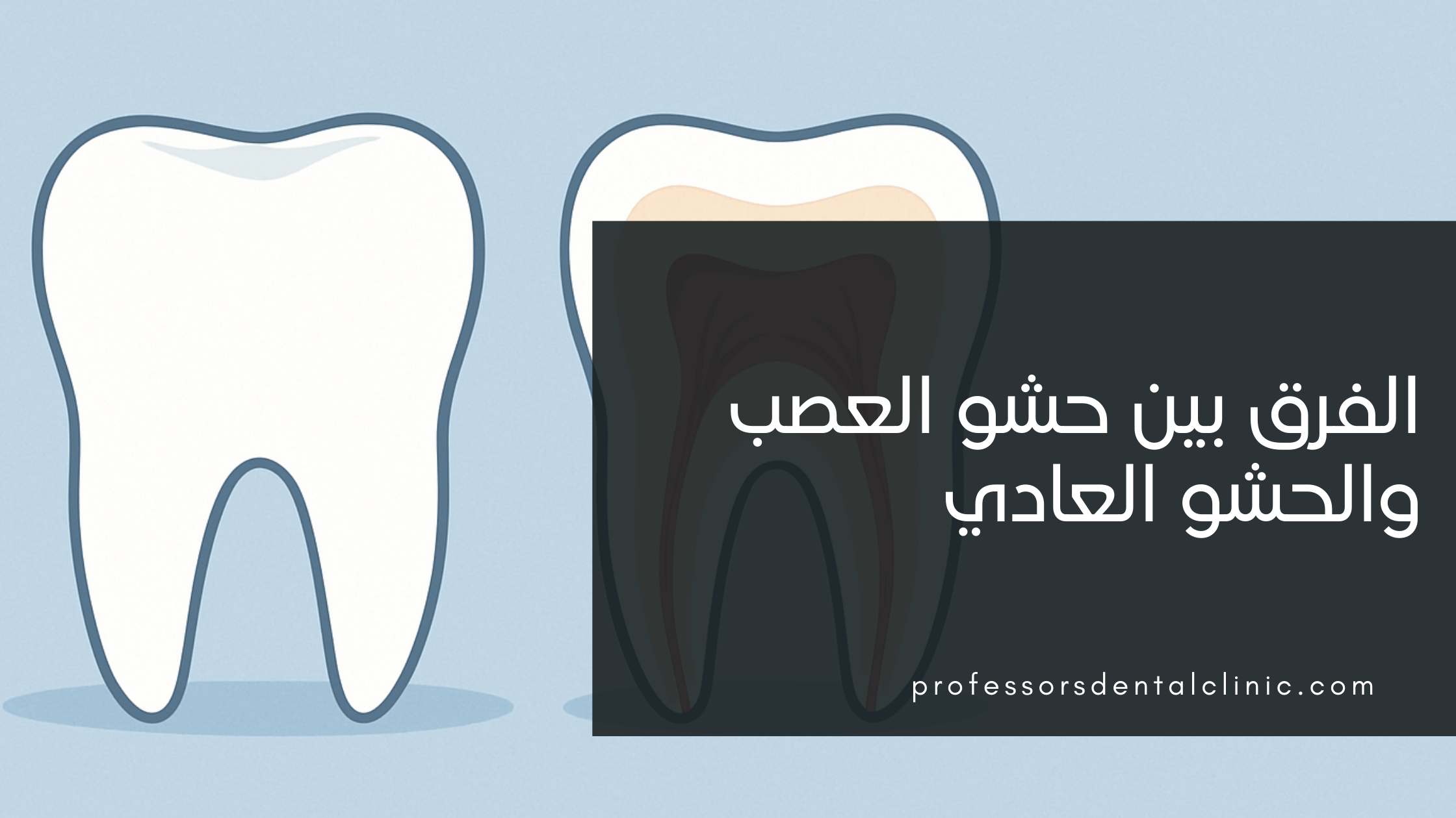 الفرق بين حشو العصب والعادي