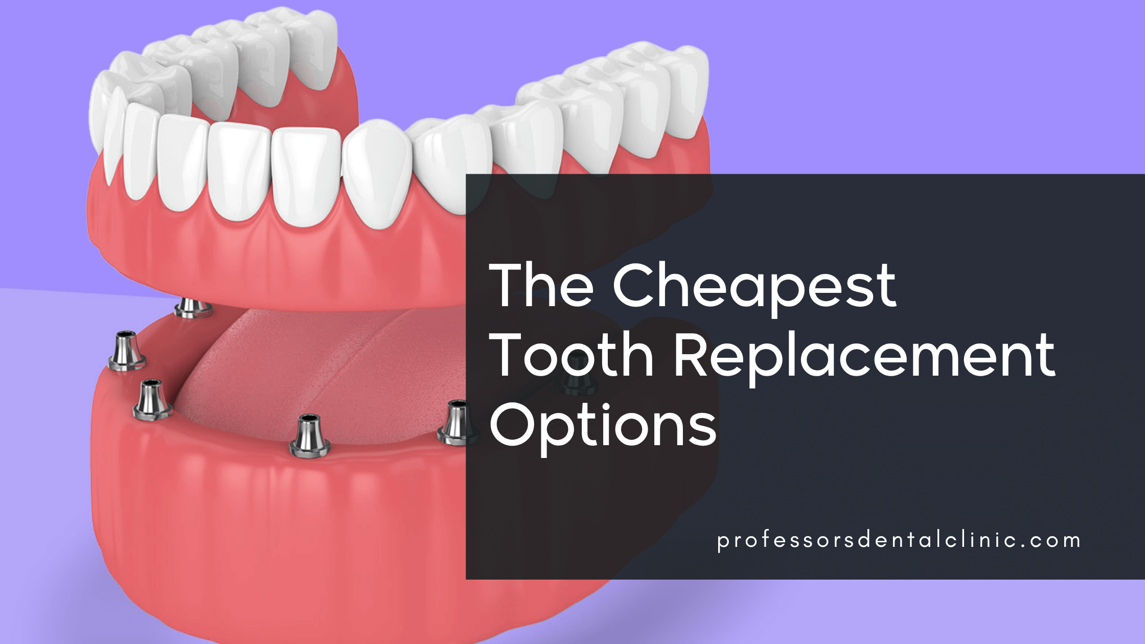 The Cheapest Way to Get New Teeth: Affordable Options Without Compromising Quality