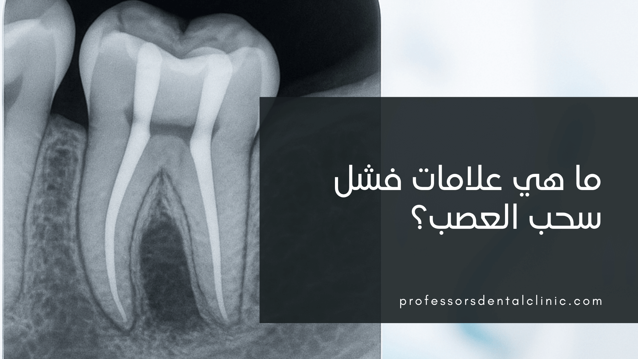 علامات فشل سحب العصب: كيف تعرف أن علاج الجذور يحتاج إعادة؟