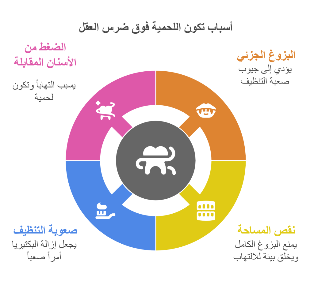 أسباب تكون اللحمية فوق ضرس العقل