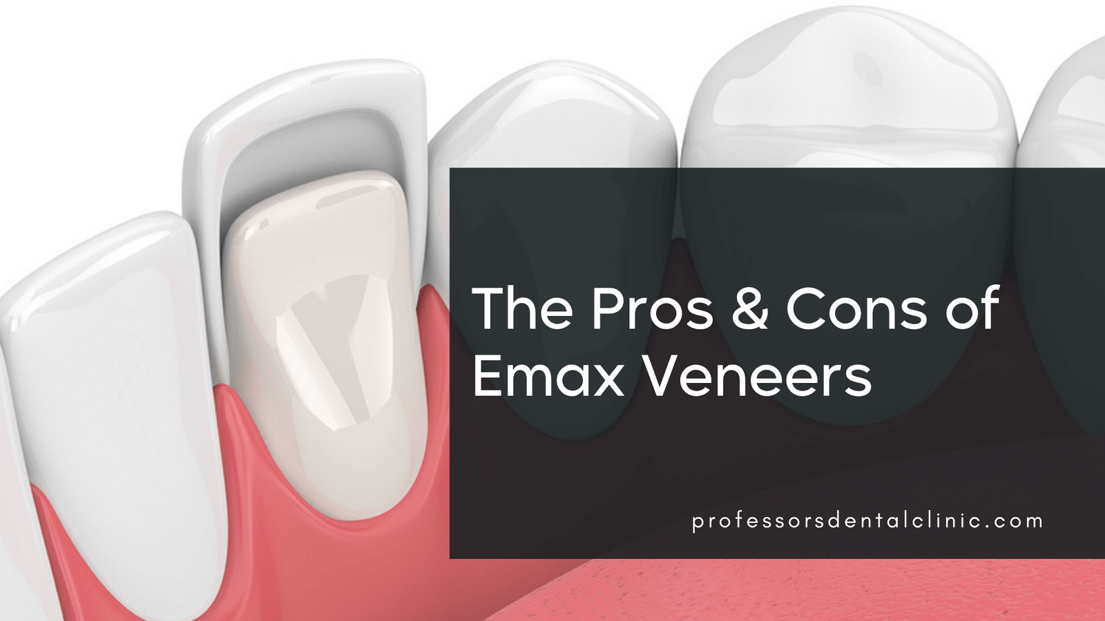 E.max Veneers Pros and Cons - Dr. Khafagy's Honest Take
