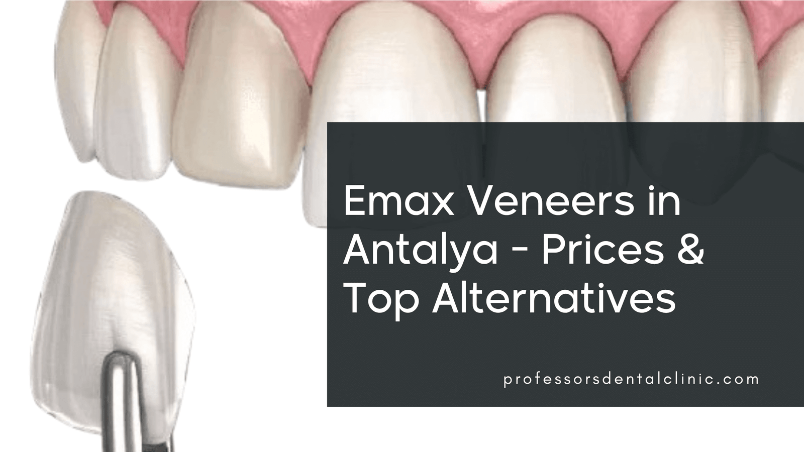Emax Veneers in Antalya A Dentist's Honest Guide
