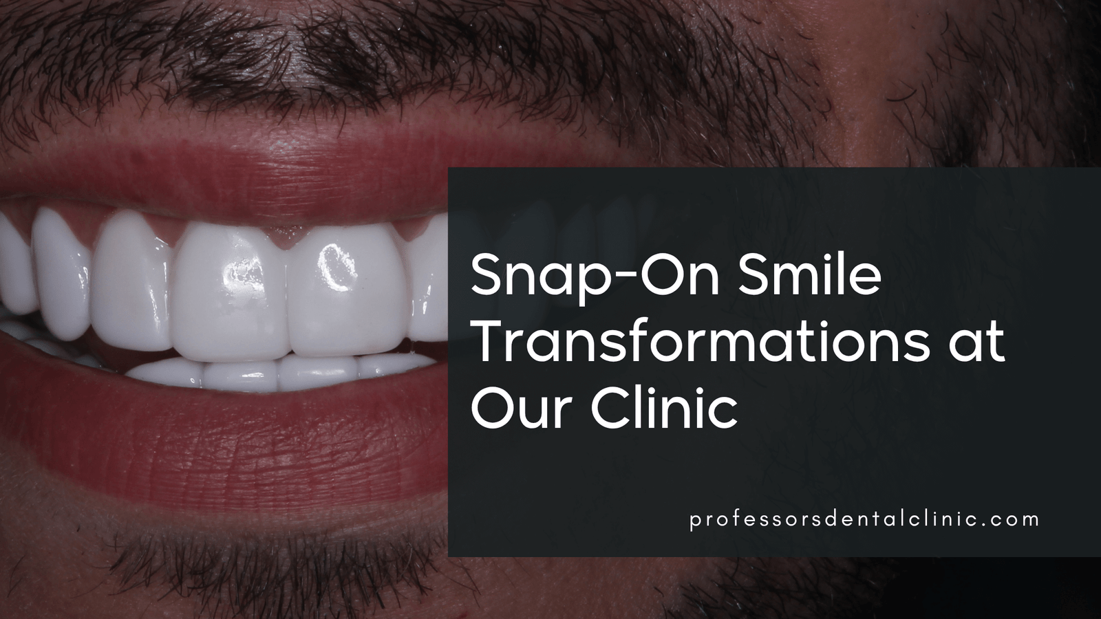 Snap-On Smile Before and After