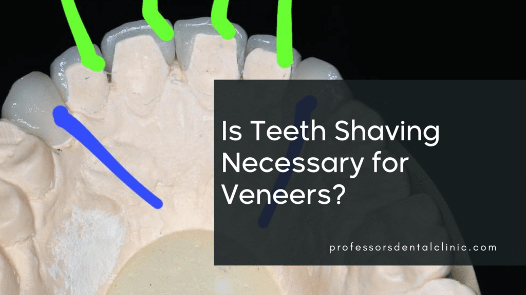 Teeth Shaving for Veneers: What You Really Need to Know