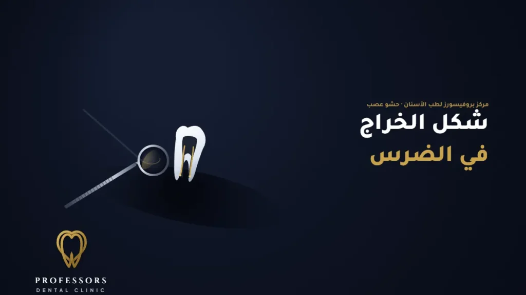 شكل الخراج في الضرس – الأعراض والأسباب والعلاج