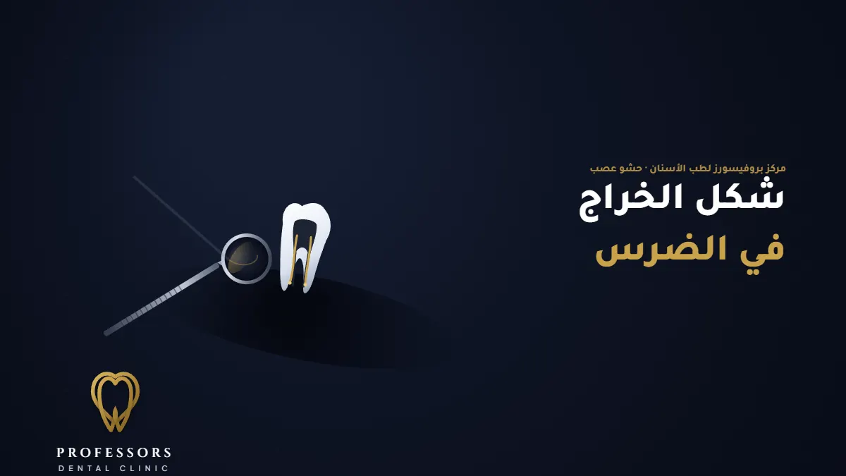 شكل الخراج في الضرس – الأعراض والأسباب والعلاج