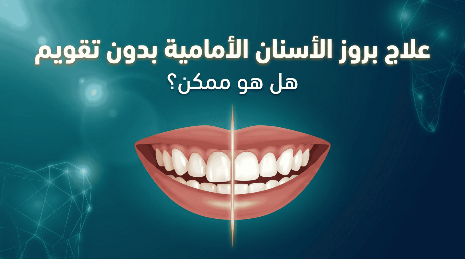 علاج بروز الأسنان الأمامية بدون تقويم - هل ممكن