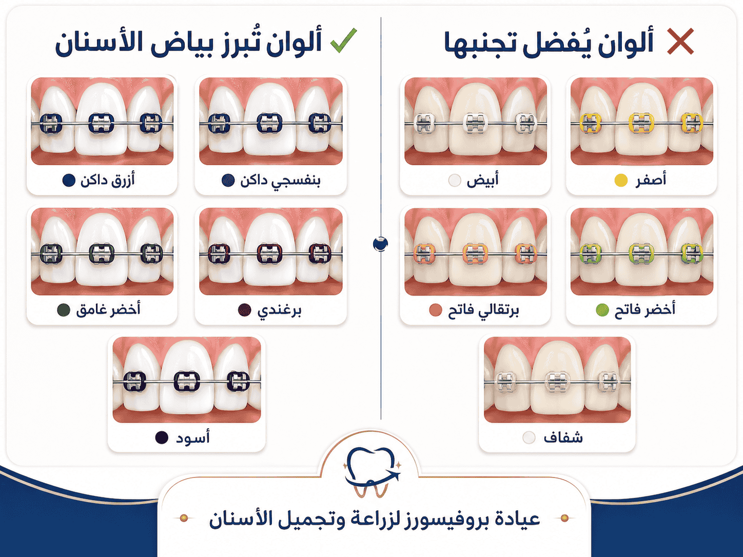 ألوان تقويم تجعل الأسنان تبدو أكثر بياضًا